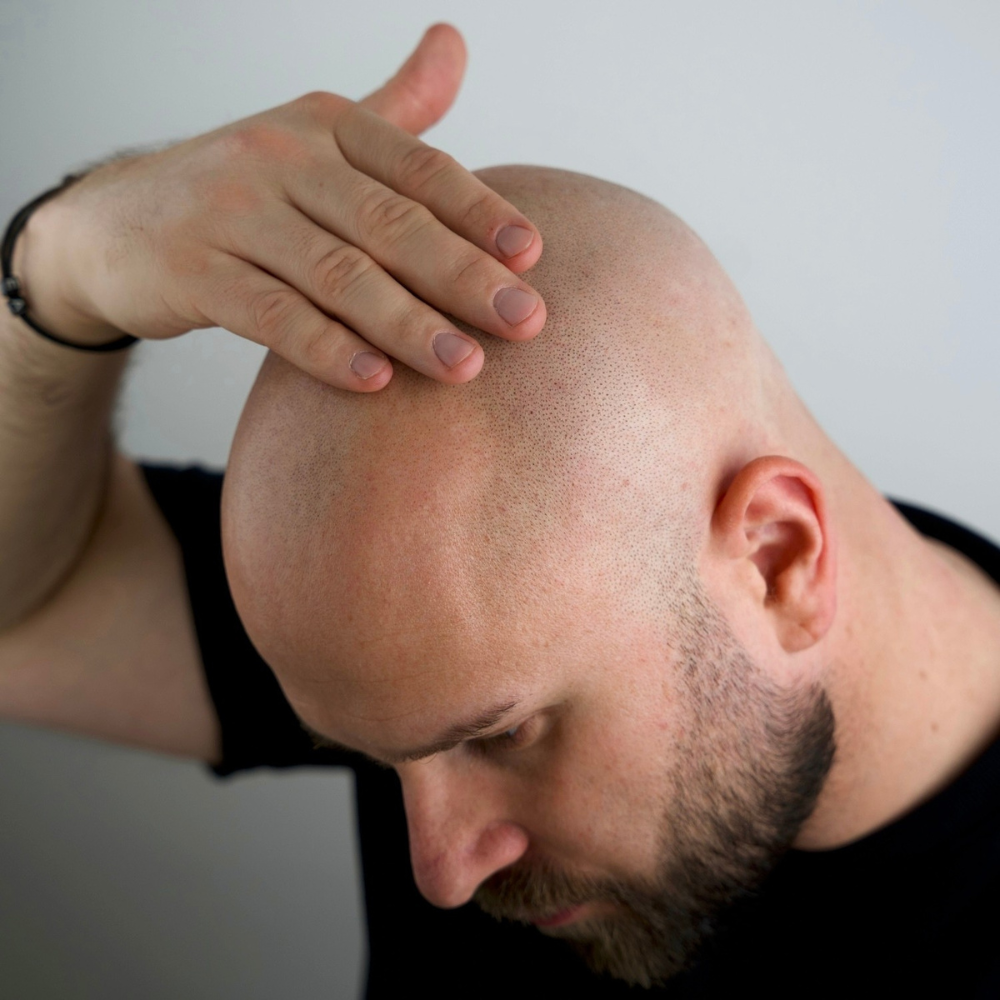 Magic Glatzen & Bartöl - 30ml Bartö BetterBeBold